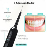 High Frequency Electric Ultrasonic Dental Tartar Plaque Calculus Tooth Remover Set Kits Cleaner with LED Screen