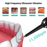 High Frequency Electric Ultrasonic Dental Tartar Plaque Calculus Tooth Remover Set Kits Cleaner with LED Screen